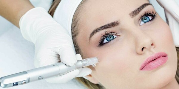 Microneedling